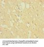 ZNF396 Antibody