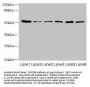 ZNF398 Antibody