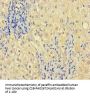 ZNF404 Antibody