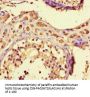 ZNF408 Antibody
