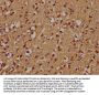 ZNF420 Antibody