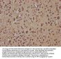 ZNF423 Antibody