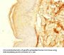 ZNF513 Antibody