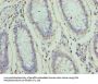 ZNF555 Antibody