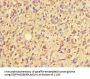 ZNF559 Antibody