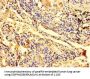 ZNF559 Antibody