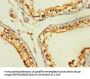 ZNF562 Antibody