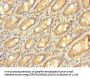 ZNF562 Antibody