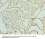 ZNF563 Antibody