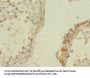 ZNF564 Antibody