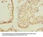 ZNF582 Antibody