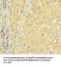 ZNF583 Antibody