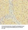 ZNF583 Antibody