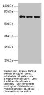 ZNF614 Antibody