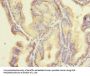 ZNF614 Antibody
