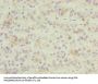 ZNF622 Antibody