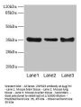 ZNF625 Antibody