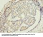 ZNF626 Antibody