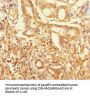 ZNF627 Antibody