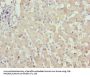 ZFP69B Antibody