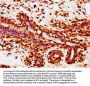 ZNF644 Antibody