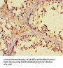 ZNF662 Antibody