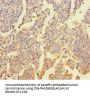 ZNF662 Antibody