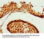 ZNF679 Antibody