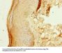 ZNF688 Antibody