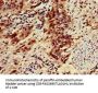ZNF695 Antibody