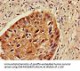 ZNF695 Antibody