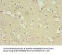 ZNF699 Antibody