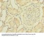ZNF707 Antibody