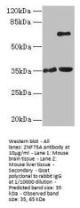 ZNF75A Antibody