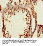 ZNF77 Antibody