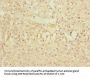 ZNF791 Antibody