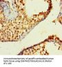 ZNF800 Antibody