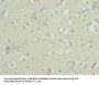 ZNF821 Antibody