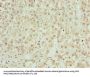 ZNF821 Antibody
