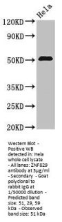 ZNF829 Antibody
