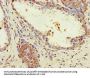 ZNF844 Antibody