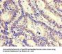 ZNF844 Antibody
