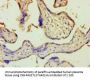 ZRANB2 Antibody