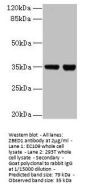 ZBED1 Antibody