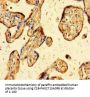 ZBED1 Antibody