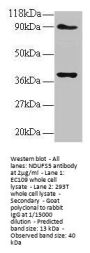 NDUFS5 Antibody