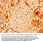 TXN Antibody