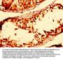TXN Antibody