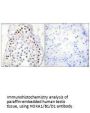 HOXB1/HOXA1/HOXD1 Antibody