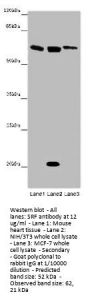 SRF Antibody